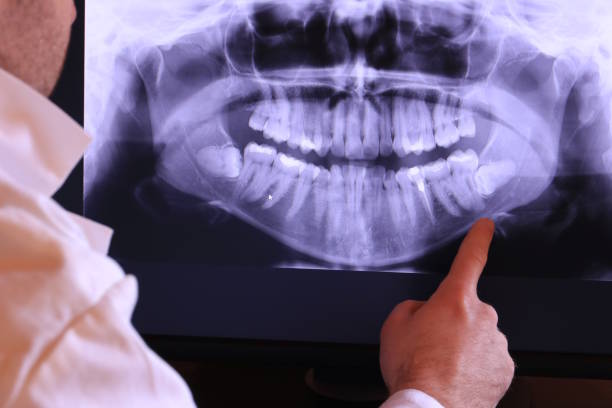 Best Emergency Tooth Extraction in Dundee, MI