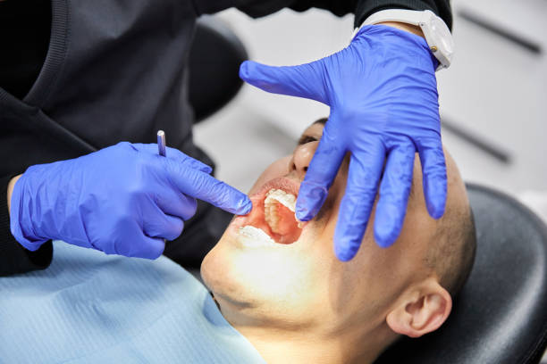 Best Urgent Care for Lost Fillings or Crowns in Dundee, MI