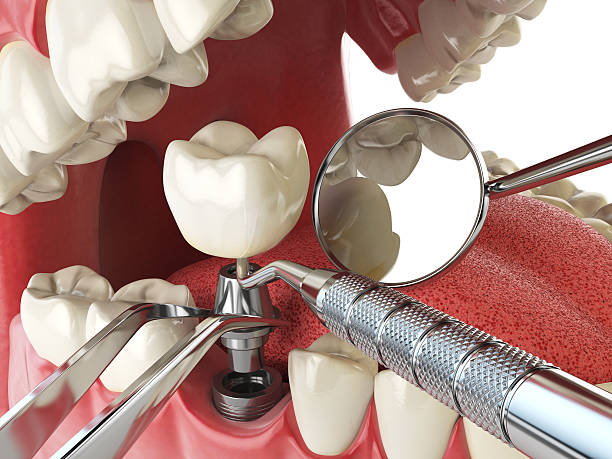 Fast & Reliable Emergency Dental Services in MI